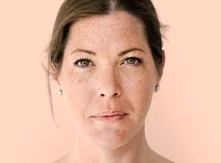 preventing age spots on mature skin