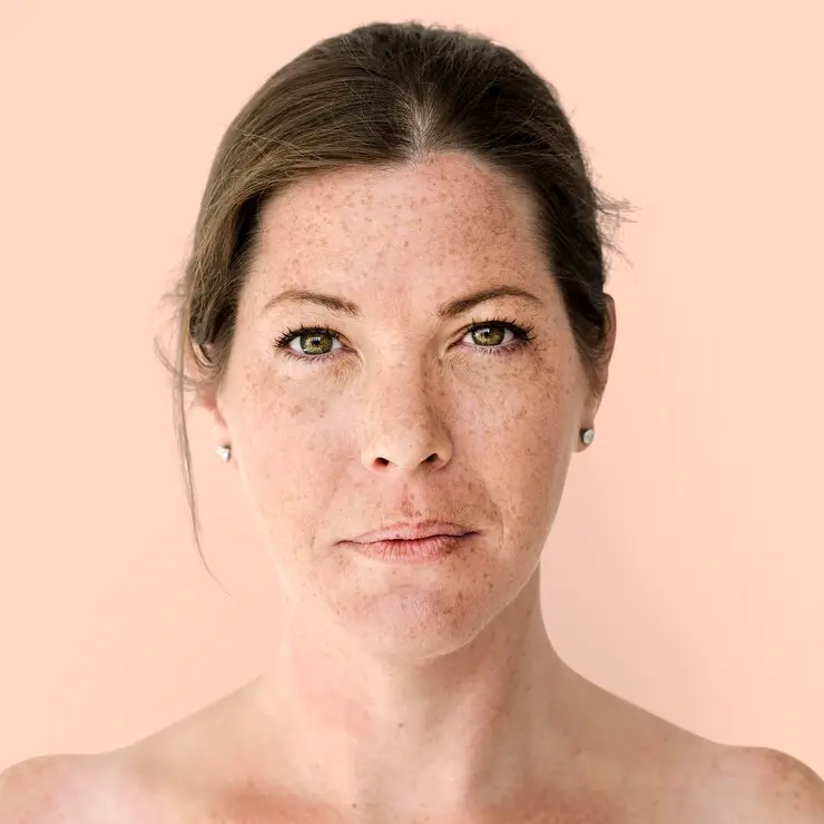 preventing age spots on mature skin