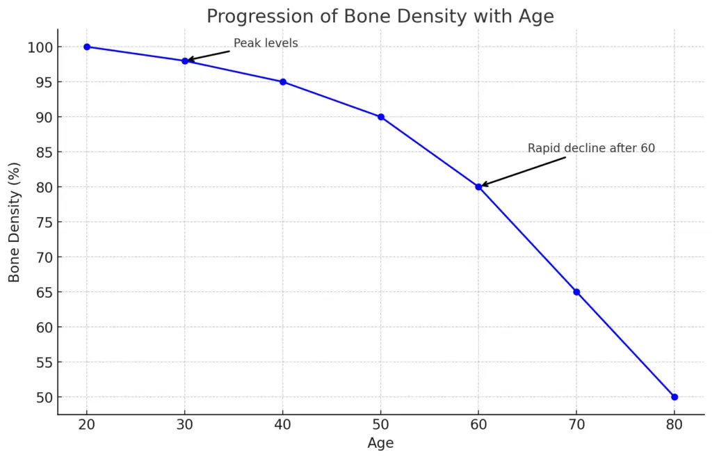 Here's a chart illustrating the progression of bone density from peak levels in the 20s and 30s, through gradual decline after age 40, and showing more rapid loss by age 60