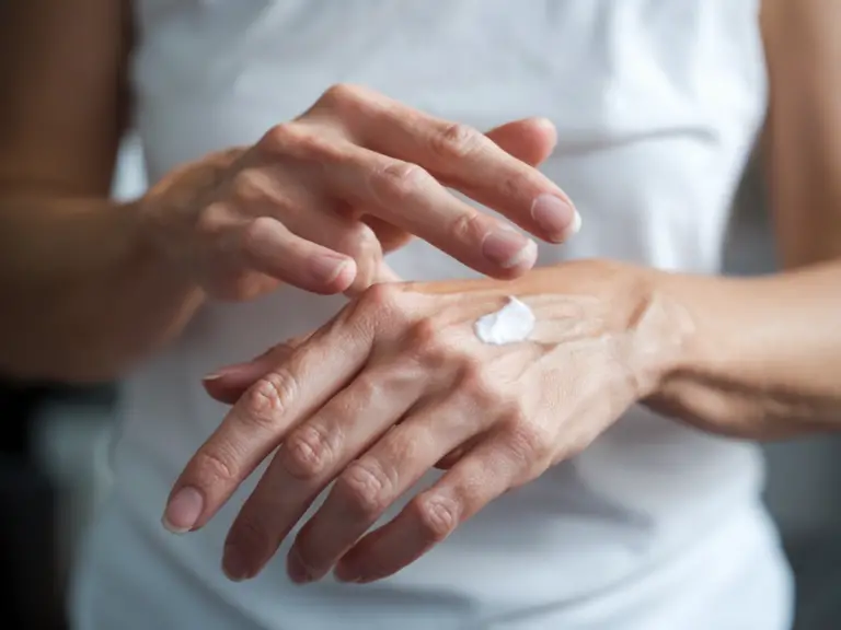 Woman's hands applying sunscreen lotion to prevent age spots.