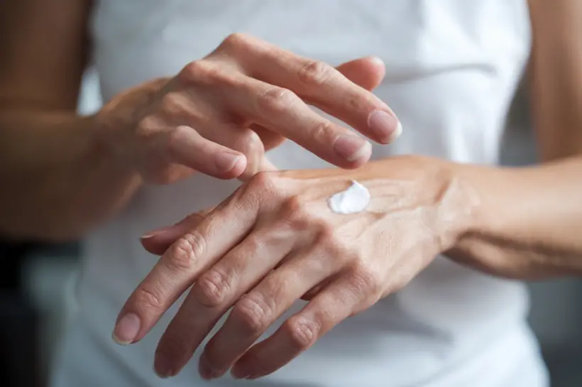 Woman's hands applying sunscreen lotion to prevent age spots.